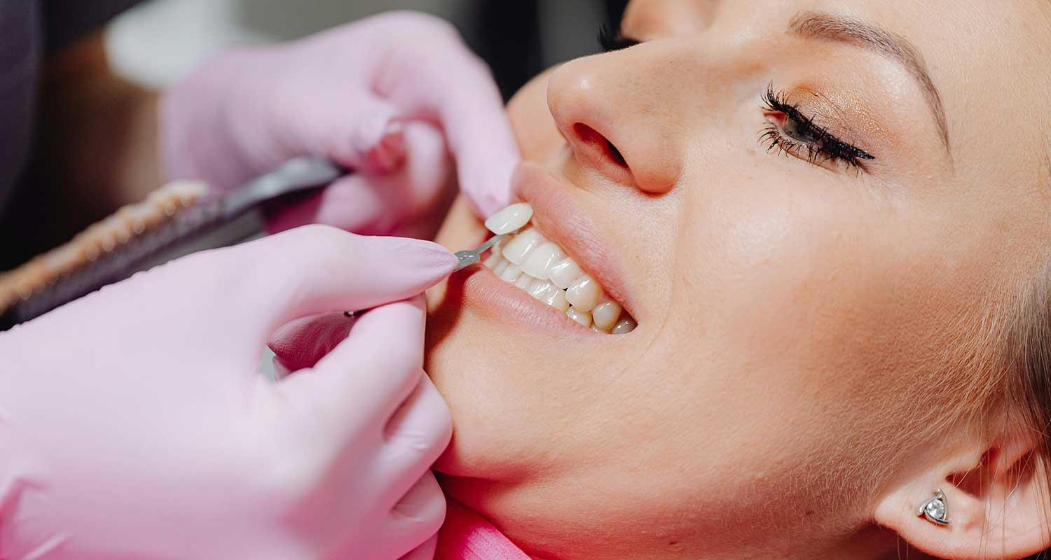 Eine Frau auf einem Zahnarzt-Behandlungsstuhl. Sie bekommt Veneers auf ihre Schneidezähne gesetzt. Die Zahnlounge in Zürich-Enge bietet Veneers an, um Fehlstellungen und Verfärbungen auszugleichen.